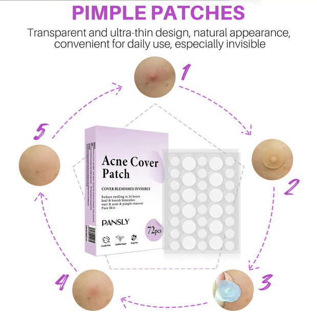 Patch anti-acné 72 pièces, invisibles et adaptés à un usage quotidien, pour un teint clair et naturel